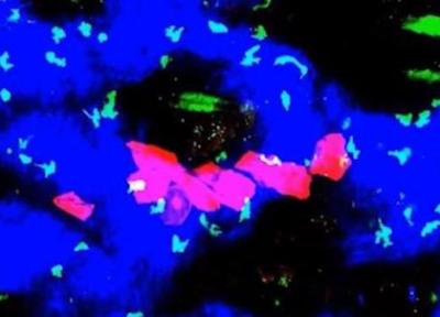 زنان مراقب باشند؛ میان آپنه خواب و ابتلا به سرطان ارتباط وجود دارد زنان مراقب باشند؛ میان آپنه خواب و ابتلا به سرطان ارتباط وجود دارد